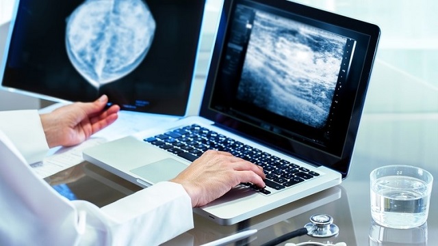  Cáncer de mama: un programa de inteligencia artificial ayuda a evitar los diagnósticos fallidos de los médicos