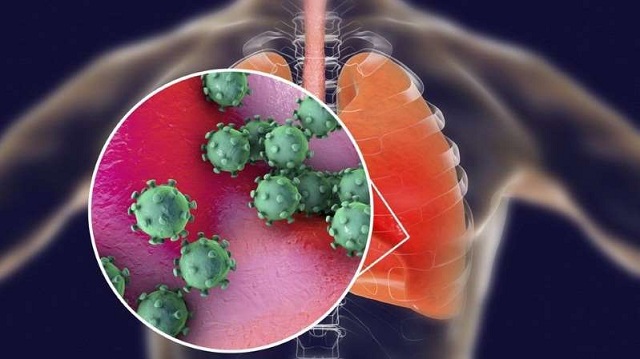 Qué le hace el coronavirus al cuerpo y qué pasó con los primeros pacientes de la enfermedad