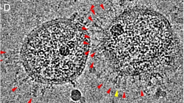  Captan las primeras imágenes con la forma real del nuevo coronavirus