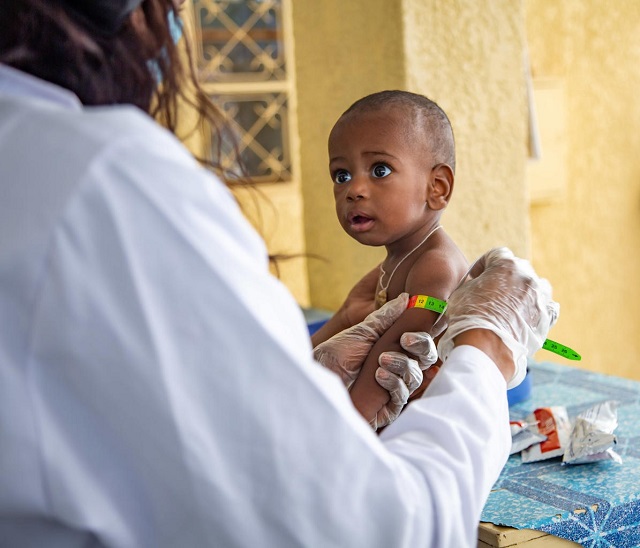  Otros 6,7 millones de niños menores de 5 años podrían sufrir de desnutrición aguda severa este año debido a la COVID-19, según UNICEF