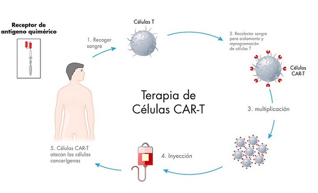  Terapia con células T mejora tasas de supervivencia en casos de Linfoma según informe del World Cancer Research Fund International