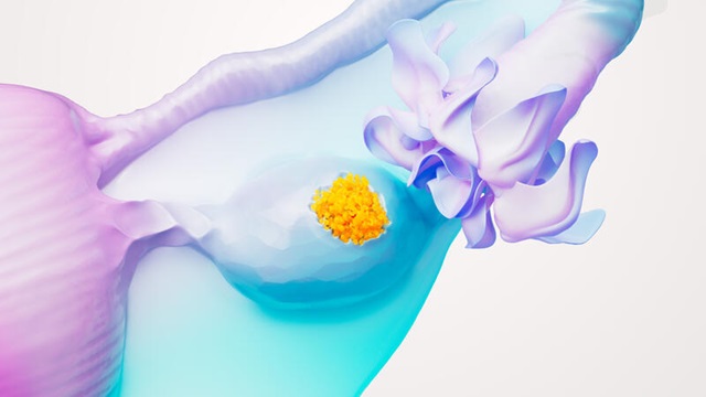  Día Mundial de la Lucha contra el Cáncer de Ovario: Destacan la importancia de la detección temprana