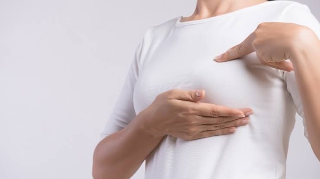  El cáncer de mama inflamatorio puede avanzar rápidamente y a menudo no presenta un bulto como señal de alerta